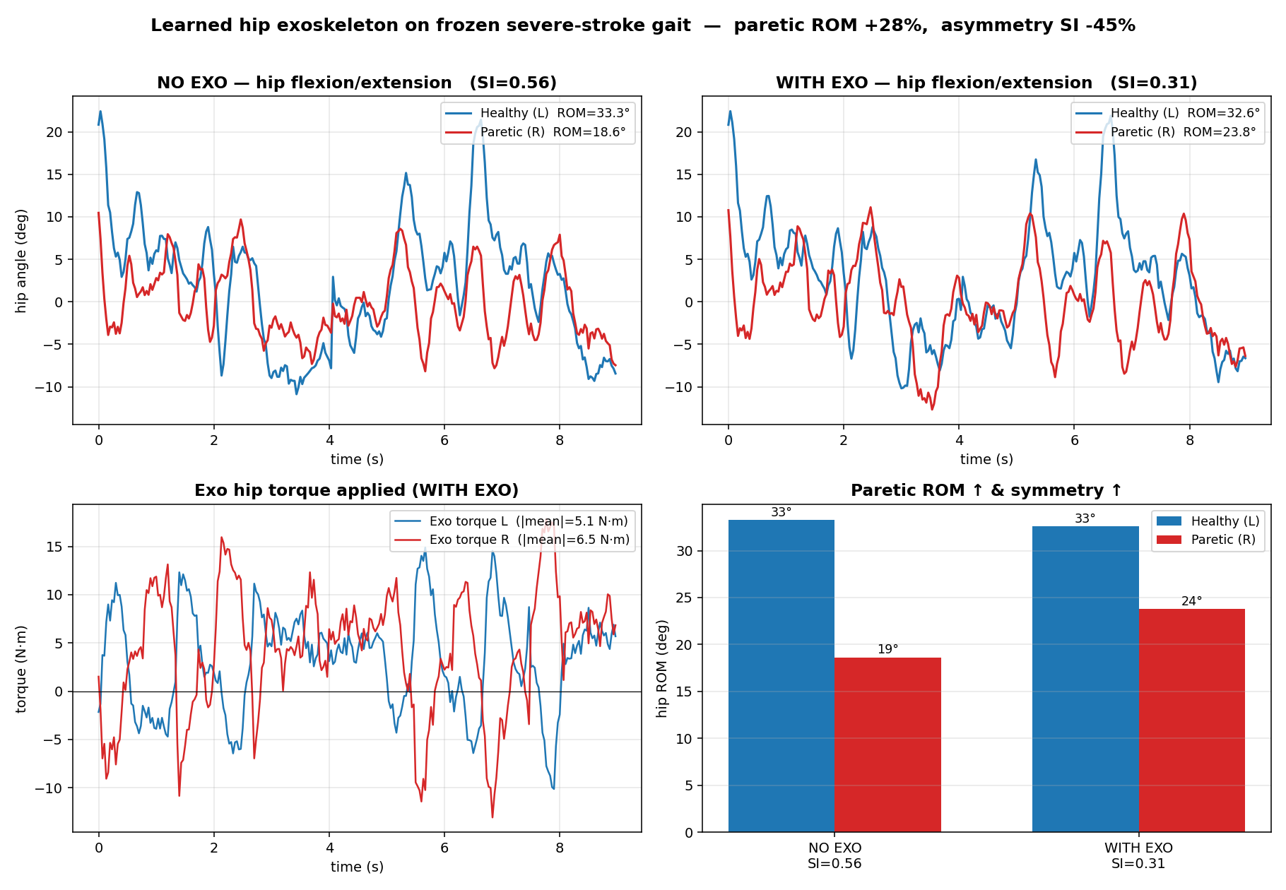 Charts for a learned hip exoskeleton on frozen severe-stroke gait: hip flexion and extension without and with the exoskeleton, the applied exoskeleton hip torque, and paretic range of motion and symmetry.